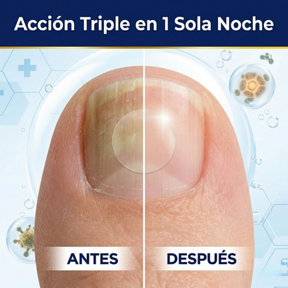 NightFungal Pro™ — Elimina el Hongo de las Uñas Mientras Duermes.